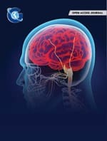 Association of Cerebral Hemodynamics and Anemia on Processing Speed in Adults with Sickle Cell Disease